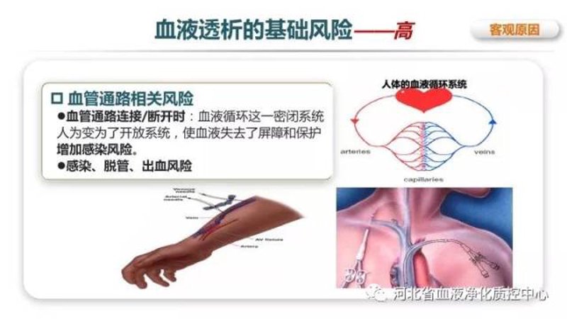 血液透析管理系统